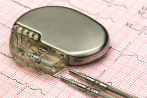 close up of pacemaker