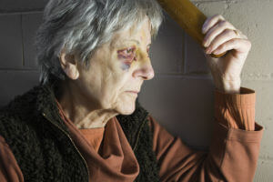 elderly woman with bruised eye