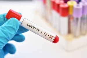 positive test for COVID-19
