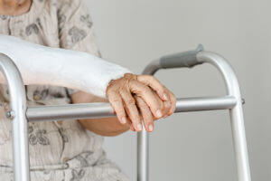 Elderly woman with cast