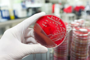 petri dish with dangerous bacteria