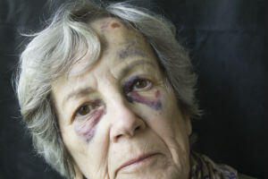 abused elderly woman