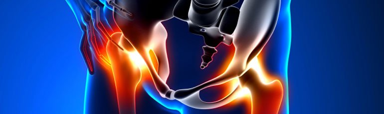 hip replacement injury lawyer