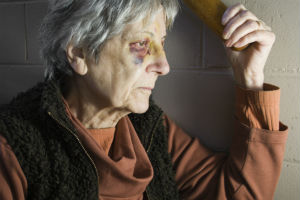 woman depressed with bruises on face