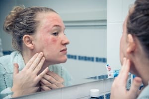 inspecting skin in a mirror