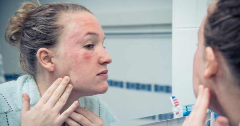 Facial Injuries After a Wisconsin Crash: Can I Sue for Damages?